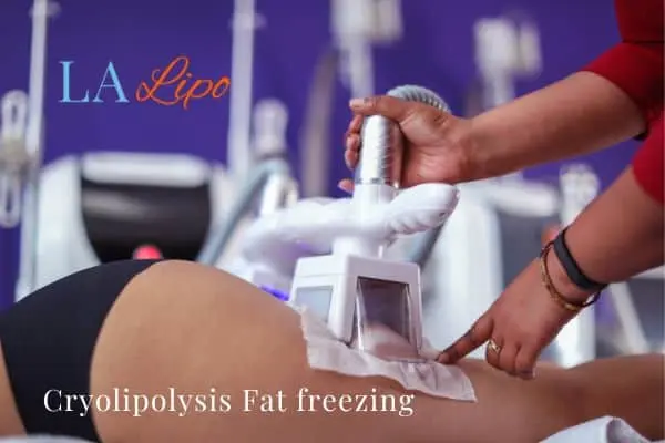 women getting fat freezing Sevenoaks