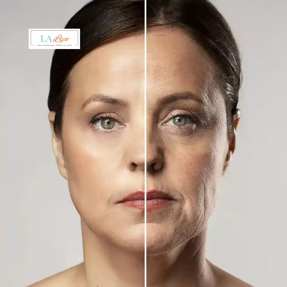 How Can You Tell If Non-Surgical Skin Tightening Is Right for You Sevenoaks?