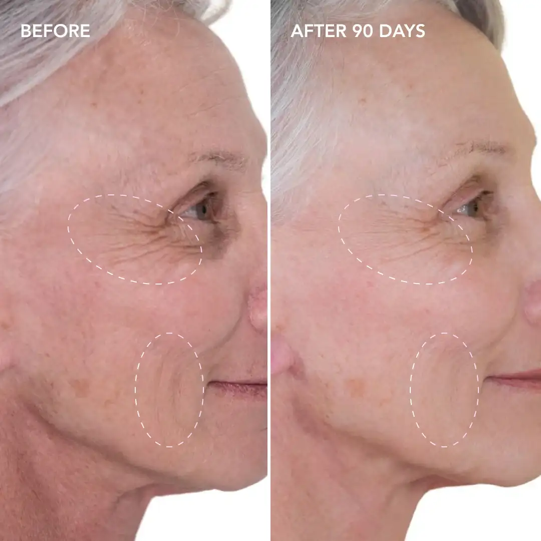 When will you see results Sevenoaks